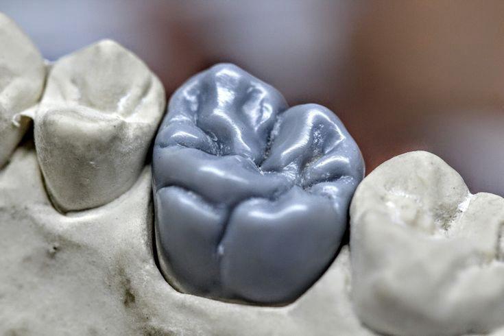 Why Zirconia Crowns Are the Future of Dentistry