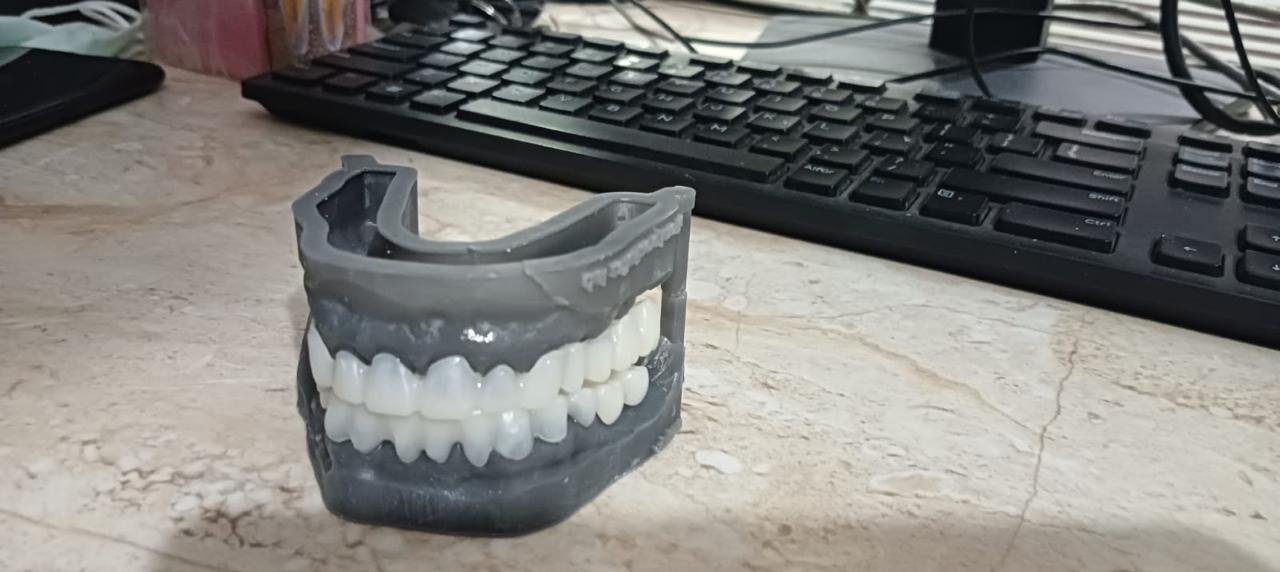 Digital Dentures vs Traditional Dentures – Which Is Better?