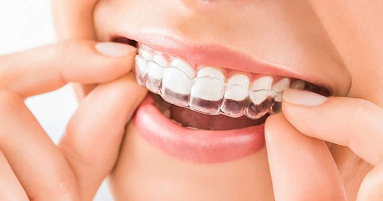 The Importance of Night Guards for Teeth Protection
